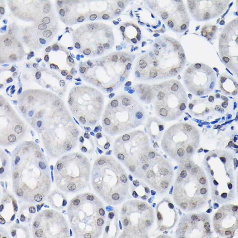 Immunohistochemistry - Anti-SSNA1 Antibody (A88290) - Antibodies.com