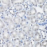 Immunohistochemistry - Anti-SSNA1 Antibody (A88290) - Antibodies.com