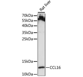 Western Blot - Anti-LEC Antibody (A88291) - Antibodies.com