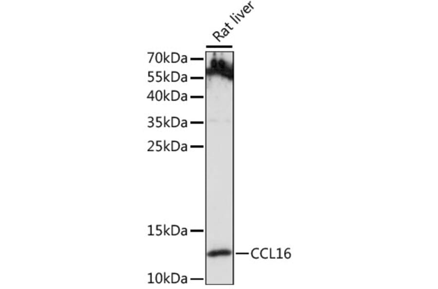 Western Blot - Anti-LEC Antibody (A88291) - Antibodies.com