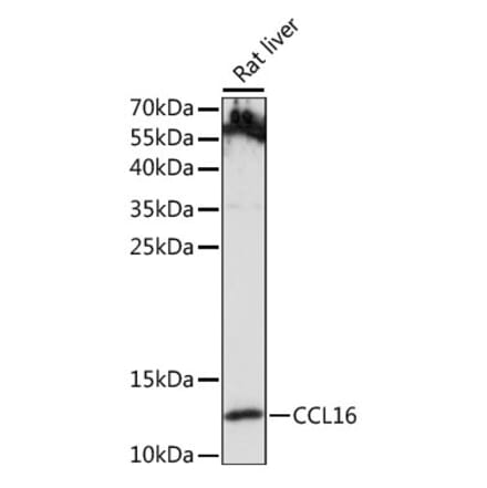 Western Blot - Anti-LEC Antibody (A88291) - Antibodies.com