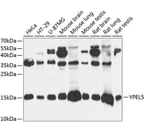 Western Blot - Anti-YPEL5 Antibody (A88292) - Antibodies.com