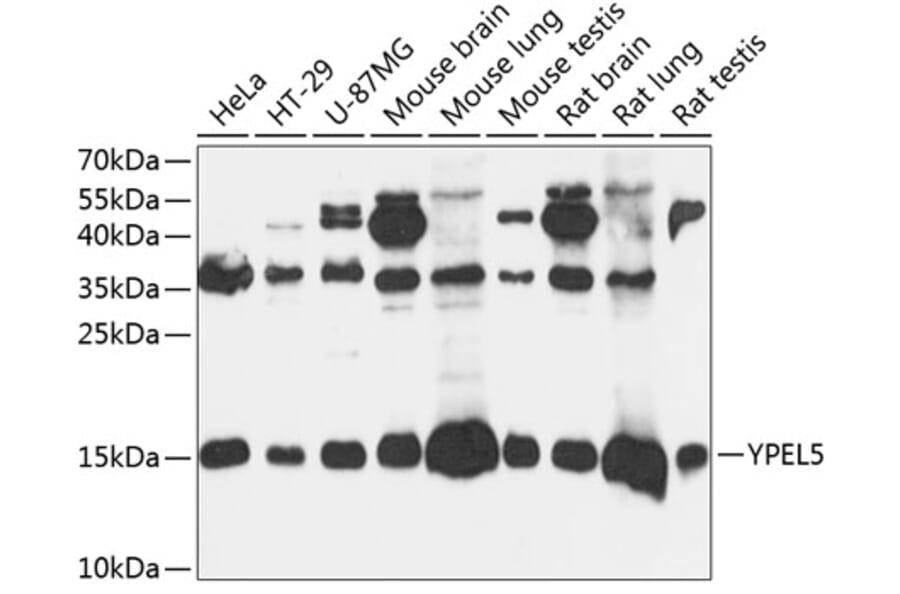 Western Blot - Anti-YPEL5 Antibody (A88292) - Antibodies.com