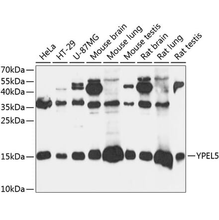 Western Blot - Anti-YPEL5 Antibody (A88292) - Antibodies.com
