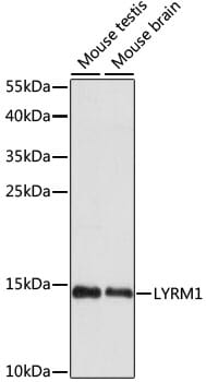 Western blot analysis of extracts of various cell lines, using Anti-LYRM1 Antibody (A15483) at 1:1,000 dilution.
Secondary antibody: Goat Anti-Rabbit IgG (H+L) (HRP) (AS014) at 1:10,000 dilution.
Lysates / proteins: 25µg per lane.
Blocking buffer: 3% non-fat dry milk in TBST.
Detection: ECL Basic Kit (RM00020).
Exposure time: 90s.