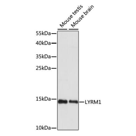 Western Blot - Anti-LYRM1 Antibody (A88293) - Antibodies.com