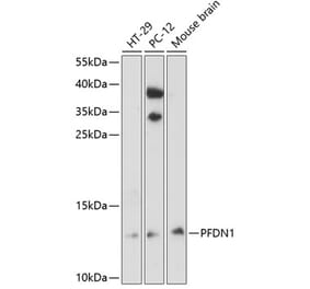 Western Blot - Anti-PFDN1 Antibody (A88294) - Antibodies.com