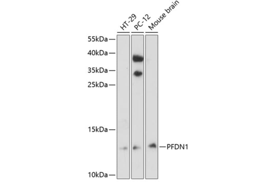 Western Blot - Anti-PFDN1 Antibody (A88294) - Antibodies.com