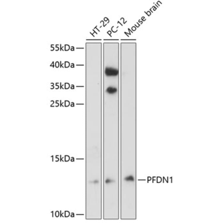 Western Blot - Anti-PFDN1 Antibody (A88294) - Antibodies.com