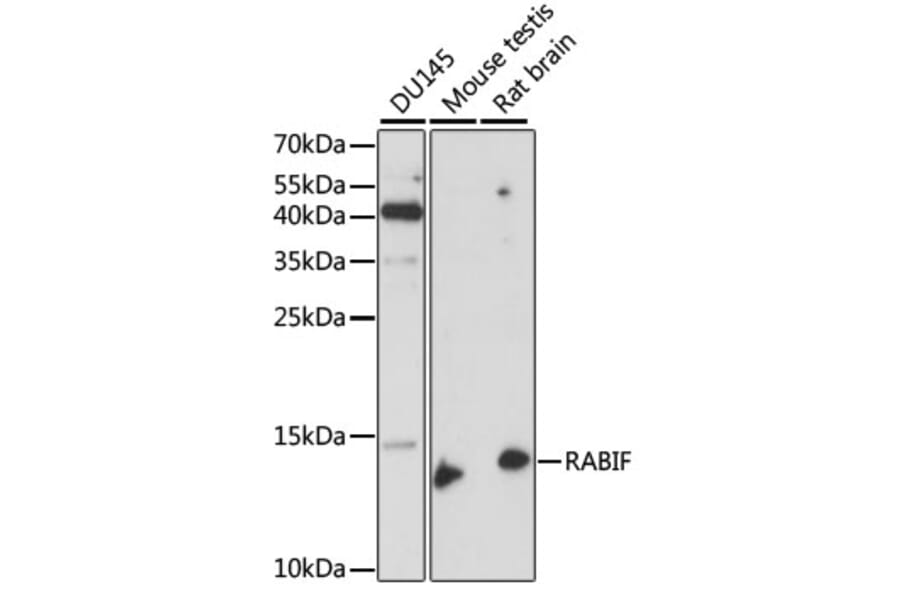 Western Blot - Anti-RABIF Antibody (A88295) - Antibodies.com