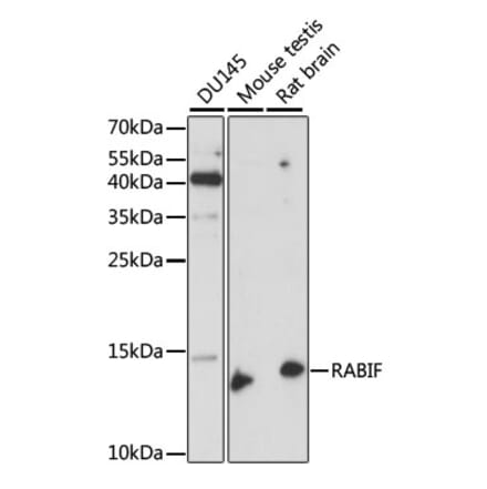 Western Blot - Anti-RABIF Antibody (A88295) - Antibodies.com