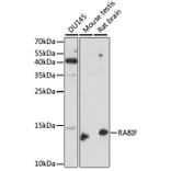 Western Blot - Anti-RABIF Antibody (A88295) - Antibodies.com