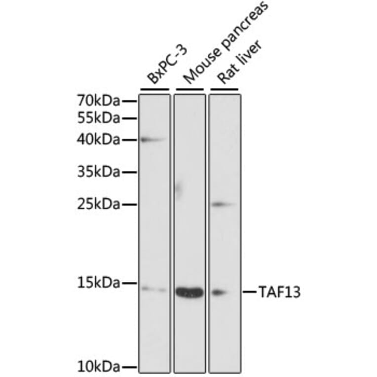Western Blot - Anti-TAF13 Antibody (A9637) - Antibodies.com