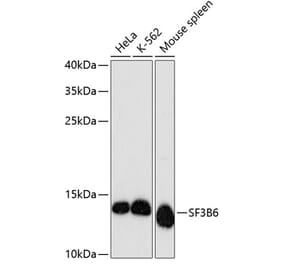 Western Blot - Anti-SF3B14 Antibody (A88298) - Antibodies.com