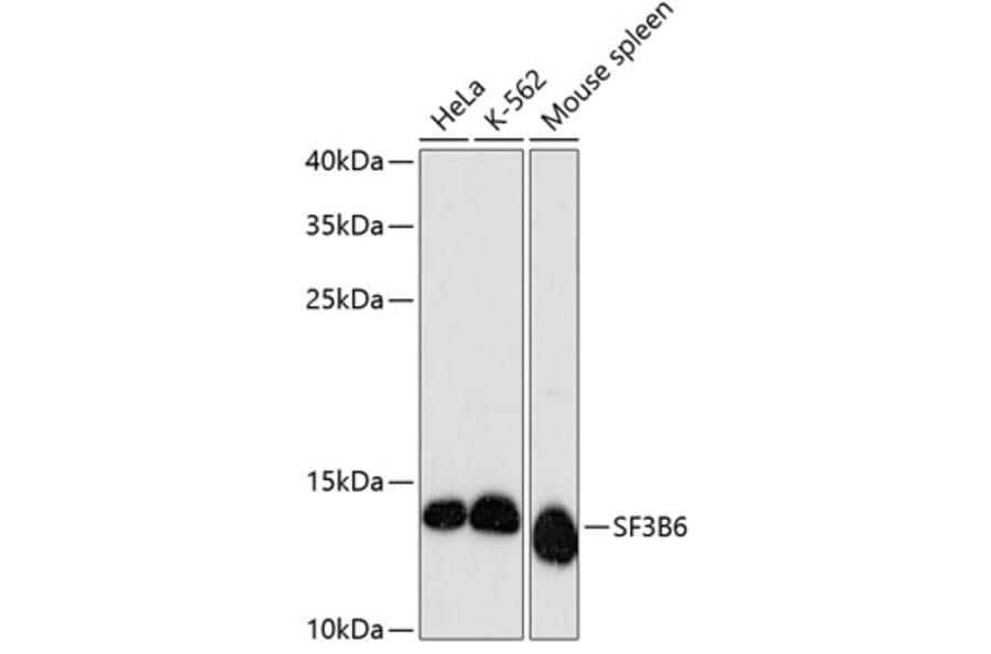 Western Blot - Anti-SF3B14 Antibody (A88298) - Antibodies.com