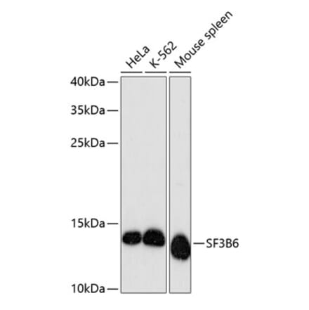 Western Blot - Anti-SF3B14 Antibody (A88298) - Antibodies.com