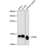 Western Blot - Anti-SF3B14 Antibody (A88298) - Antibodies.com
