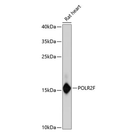 Western Blot - Anti-POLR2F Antibody (A88301) - Antibodies.com