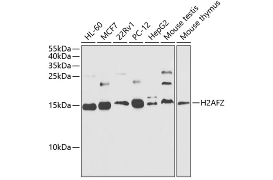 Western Blot - Anti-Histone H2A.Z Antibody (A88302) - Antibodies.com