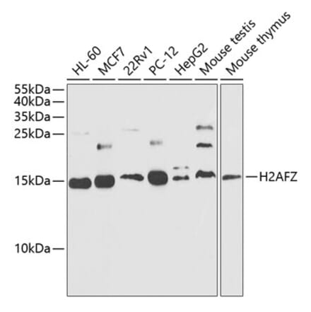 Western Blot - Anti-Histone H2A.Z Antibody (A88302) - Antibodies.com