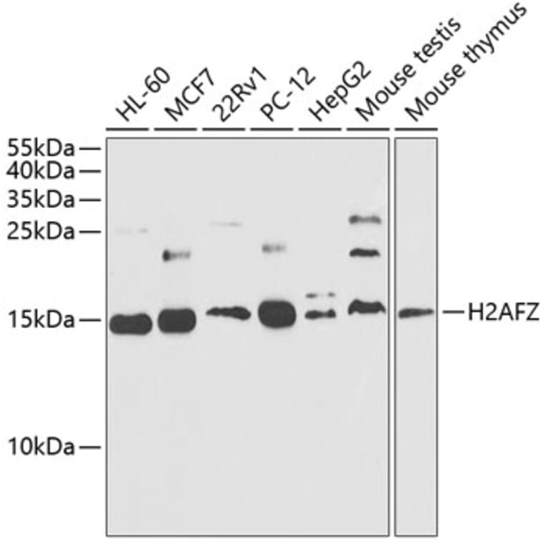 Western Blot - Anti-Histone H2A.Z Antibody (A88302) - Antibodies.com