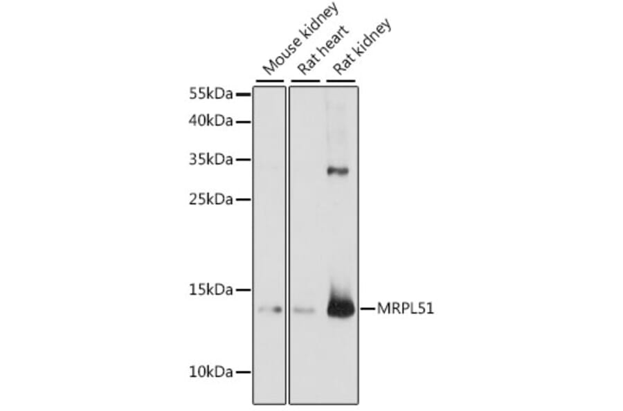 Western Blot - Anti-MRPL51 Antibody (A88303) - Antibodies.com