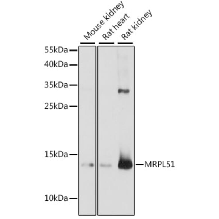 Western Blot - Anti-MRPL51 Antibody (A88303) - Antibodies.com