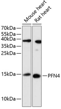 Western blot analysis of extracts of various cell lines, using Anti-PFN4 Antibody (A13692) at 1:3000 dilution.
Secondary antibody: Goat Anti-Rabbit IgG (H+L) (HRP) (AS014) at 1:10,000 dilution.
Lysates / proteins: 25µg per lane.
Blocking buffer: 3% non-fat dry milk in TBST.
Detection: ECL Enhanced Kit (RM00021).
Exposure time: 5min.