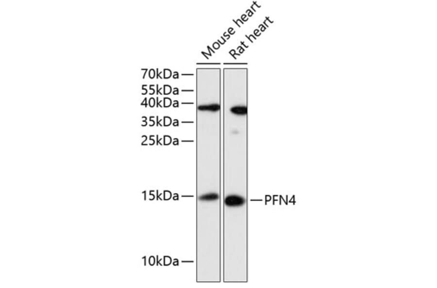 Western Blot - Anti-Profilin4 Antibody (A88304) - Antibodies.com