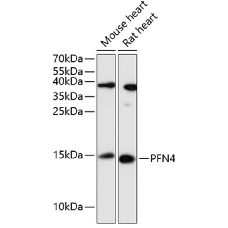 Western Blot - Anti-Profilin4 Antibody (A88304) - Antibodies.com