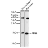 Western Blot - Anti-Profilin4 Antibody (A88304) - Antibodies.com