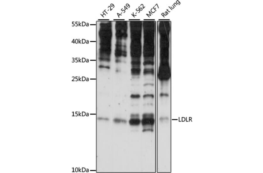 Western Blot - Anti-SNRNP25 Antibody (A88305) - Antibodies.com