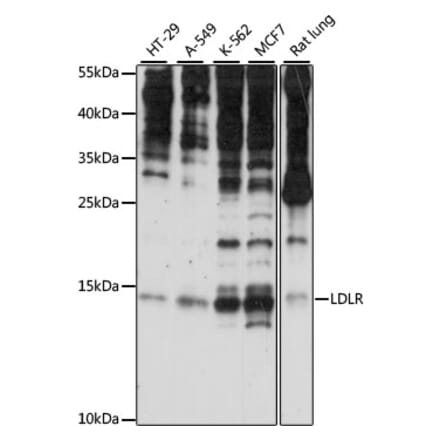 Western Blot - Anti-SNRNP25 Antibody (A88305) - Antibodies.com