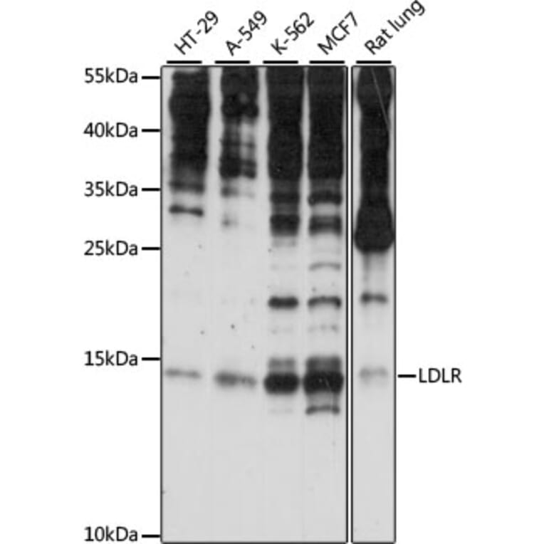 Western Blot - Anti-SNRNP25 Antibody (A88305) - Antibodies.com