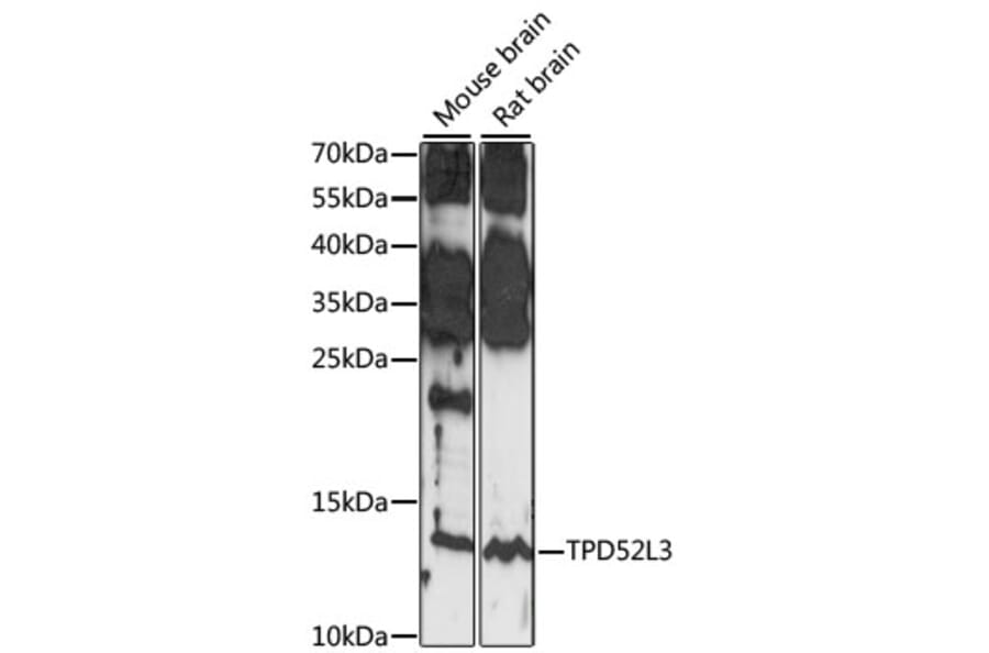 Western Blot - Anti-TPD52L3 Antibody (A88306) - Antibodies.com