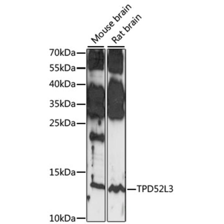 Western Blot - Anti-TPD52L3 Antibody (A88306) - Antibodies.com