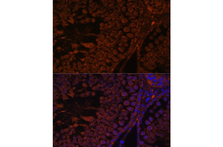 Immunofluorescence - Anti-TPD52L3 Antibody (A88306) - Antibodies.com