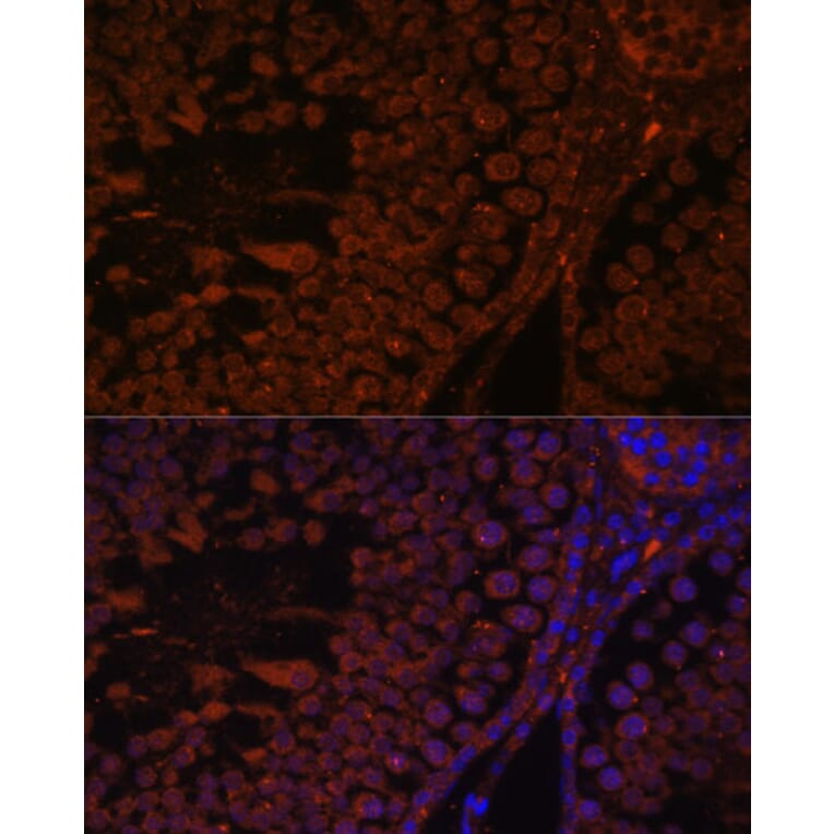 Immunofluorescence - Anti-TPD52L3 Antibody (A88306) - Antibodies.com