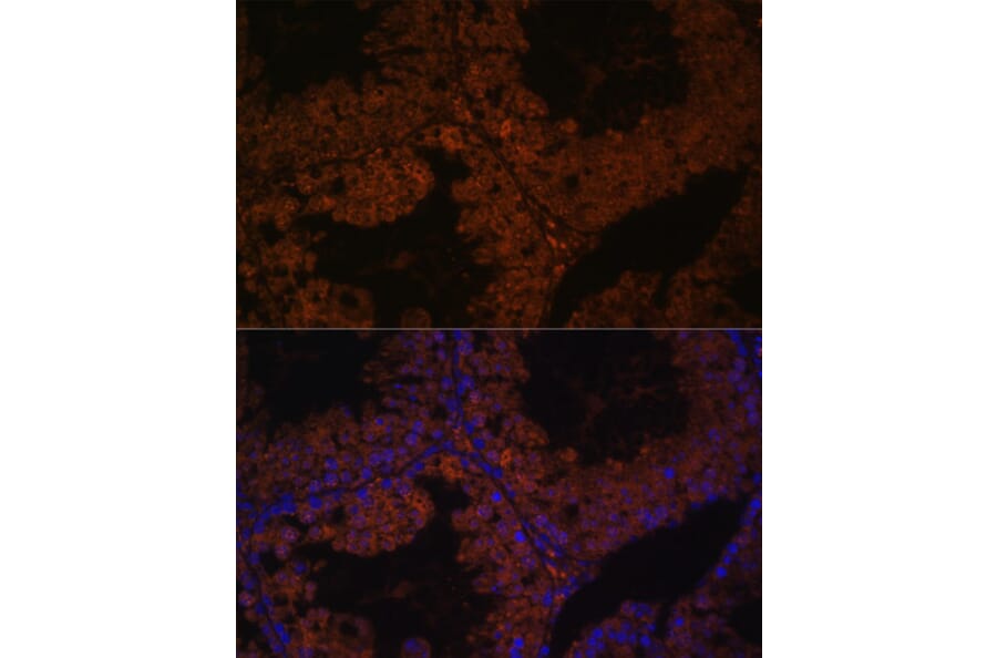Immunofluorescence - Anti-TPD52L3 Antibody (A88306) - Antibodies.com