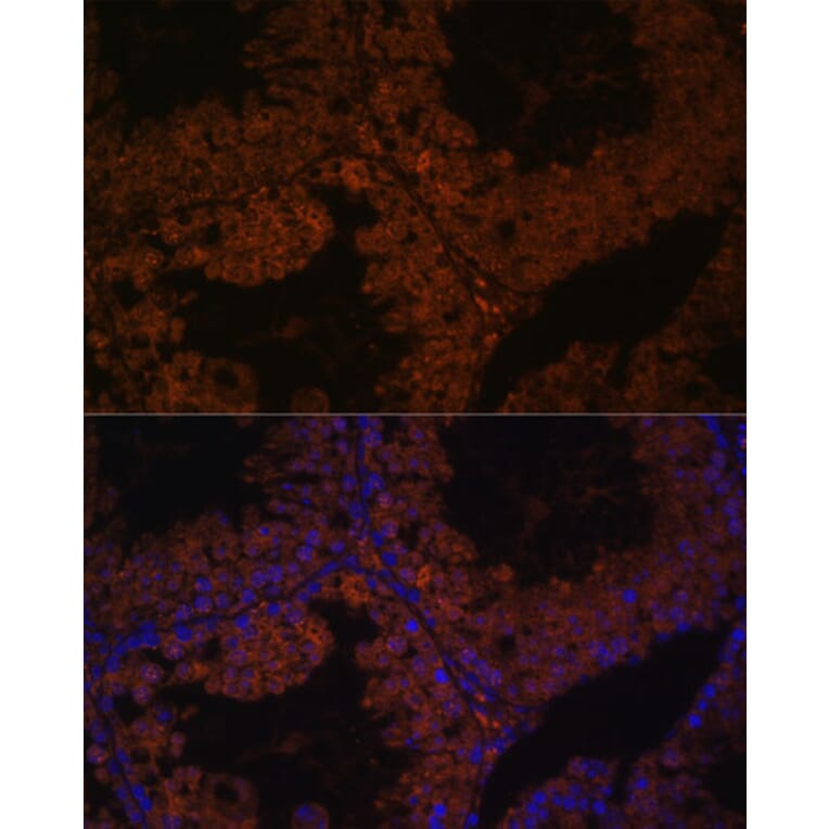 Immunofluorescence - Anti-TPD52L3 Antibody (A88306) - Antibodies.com