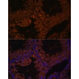 Immunofluorescence - Anti-TPD52L3 Antibody (A88306) - Antibodies.com