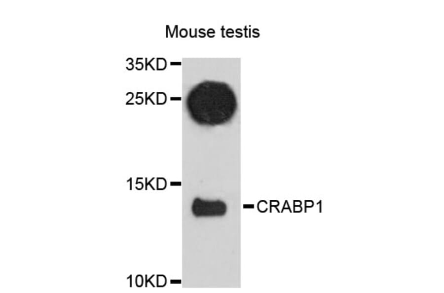 Western Blot - Anti-CRABP1 Antibody (A12707) - Antibodies.com