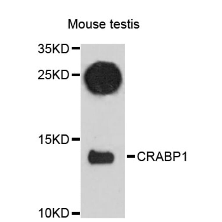 Western Blot - Anti-CRABP1 Antibody (A12707) - Antibodies.com