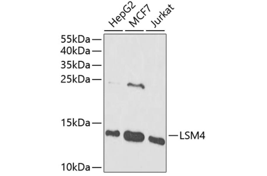 Western Blot - Anti-LSM4 Antibody (A88309) - Antibodies.com