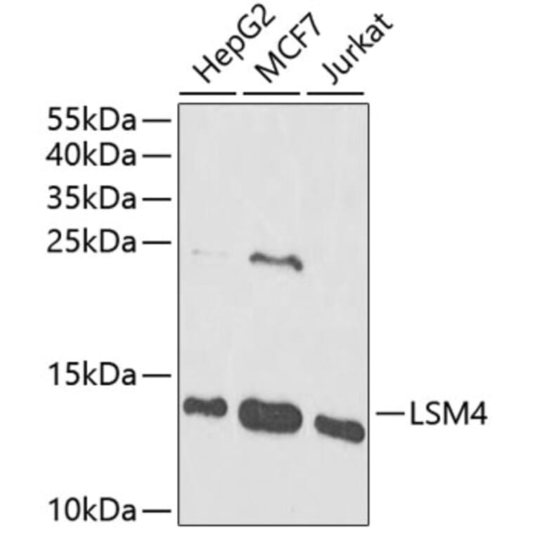 Western Blot - Anti-LSM4 Antibody (A88309) - Antibodies.com