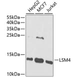 Western Blot - Anti-LSM4 Antibody (A88309) - Antibodies.com
