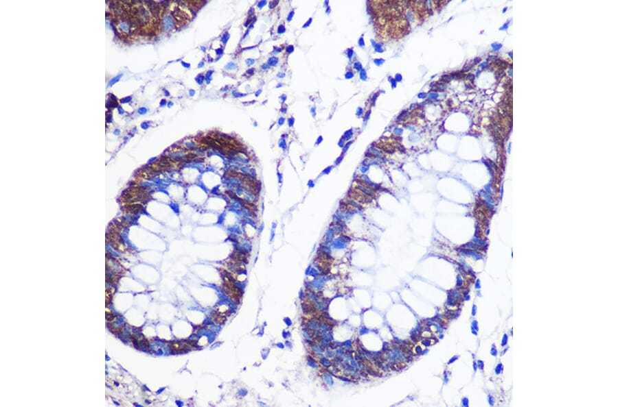 Immunohistochemistry - Anti-LSM4 Antibody (A88309) - Antibodies.com