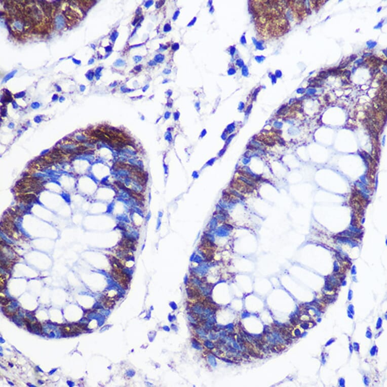 Immunohistochemistry - Anti-LSM4 Antibody (A88309) - Antibodies.com