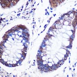 Immunohistochemistry - Anti-LSM4 Antibody (A88309) - Antibodies.com