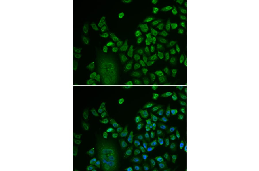 Immunofluorescence - Anti-LSM4 Antibody (A88309) - Antibodies.com